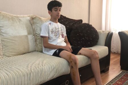 Ein 13-jähriger Junge, der in Ankara von Hunden angegriffen wurde, starb