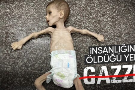 Ein weiteres Baby starb in Gaza an Hunger…