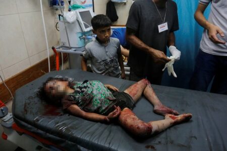 WER: Mehr als 10.000 Menschen müssen aus Gaza medizinisch evakuiert werden