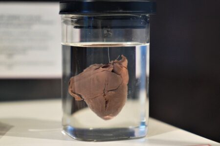 Die 150-jährige Medizingeschichte der Türkei ist im Museum in Samsun zu sehen: Die emotionalste Ecke sind „Babyherzen“