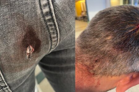 Sie haben die Unterkunft der Gemeinde Ümraniye überfallen! Sogenannte Tierliebhaber verletzten die Polizei